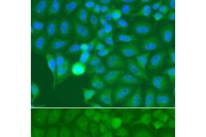 Immunofluorescence analysis of A549 cells using IRAK2 Polyclonal Antibody (IRAK2 anticorps)