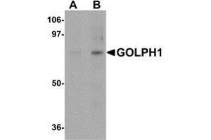 Western blot analysis of GOLPH1 in K562 cell lysate with AP30370PU-N GOLPH1 antibody at (A) 1 and (B) 2 μg/ml. (ACBD3 anticorps  (N-Term))
