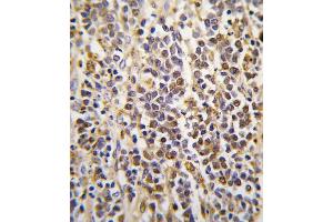 Formalin-fixed and paraffin-embedded human kidney tissue reacted with ALDH1A3 Antibody (Center), which was peroxidase-conjugated to the secondary antibody, followed by DAB staining.