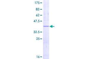 Image no. 1 for NADH Dehydrogenase (Ubiquinone) Fe-S Protein 5, 15kDa (NADH-Coenzyme Q Reductase) (NDUFS5) (AA 1-106) protein (GST tag) (ABIN1312282)