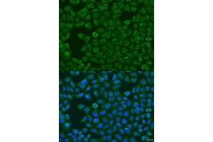 anti-Flavin Containing Monooxygenase 5 (FMO5) (AA 1-285) antibody