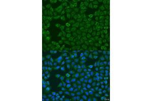 Immunofluorescence analysis of U2OS cells using FMO5 antibody (ABIN6133516, ABIN6140714, ABIN6140715 and ABIN6223596) at dilution of 1:100. (FMO5 anticorps  (AA 1-285))