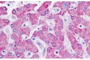 Human Liver: Formalin-Fixed, Paraffin-Embedded (FFPE)