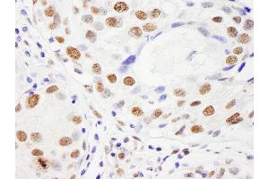 Immunohistochemistry (IHC) image for anti-Nuclear Mitotic Apparatus Protein 1 (NUMA1) (AA 2065-2115) antibody (ABIN7453748)