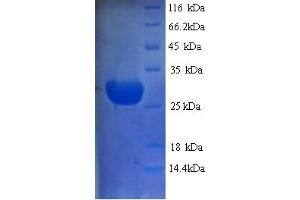 SDS-PAGE (SDS) image for Receptor (TNFRSF)-Interacting serine-threonine Kinase 1 (RIPK1) (AA 24-247) protein (His tag) (ABIN5714110)