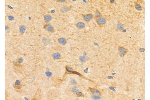 ABIN6257761 and ABIN6275829 at 1/100 staining Rat brain tissue by IHC-P.