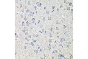 Immunohistochemistry of paraffin-embedded mouse brain using CD97 antibody (ABIN5971965) at dilution of 1/100 (40x lens). (CD97 anticorps)