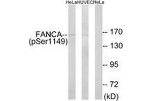 Western blot analysis of extracts from HeLa cells treated with IGF 100ng/ml 10' and HuvEc cells treated with EGF 200ng/ml 30', using FANCA (Phospho-Ser1149) Antibody. (FANCA anticorps  (pSer1149))