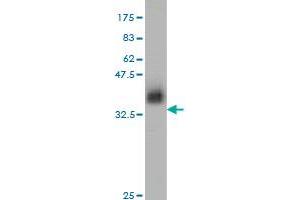 Western Blot detection against Immunogen (37. (ZNF41 anticorps  (AA 221-321))