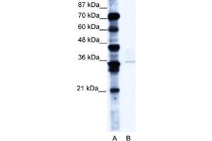 WB Suggested Anti-PCGF4 Antibody Titration:  0. (BMI1 anticorps  (C-Term))