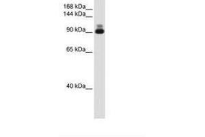 Image no. 2 for anti-Actinin, alpha 2 (ACTN2) (C-Term) antibody (ABIN204968) (ACTN2 anticorps  (C-Term))