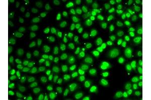 Immunofluorescence analysis of A549 cells using XPO5 antibody (ABIN5974114). (XPO5 anticorps)