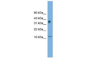 C15orf40 antibody used at 1 ug/ml to detect target protein. (C15orf40 anticorps  (Middle Region))