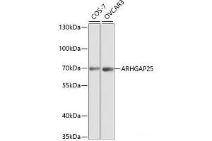 ARHGAP25 anticorps