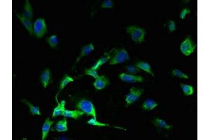 Immunofluorescent analysis of U251 cells using ABIN7166779 at dilution of 1:100 and Alexa Fluor 488-congugated AffiniPure Goat Anti-Rabbit IgG(H+L)