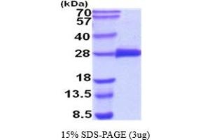 SDS-PAGE (SDS) image for C-Reactive Protein (CRP) (AA 20-225) protein (His tag) (ABIN5854491)