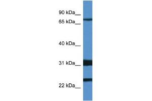 WB Suggested Anti-Kcnd1 Antibody   Titration: 1.