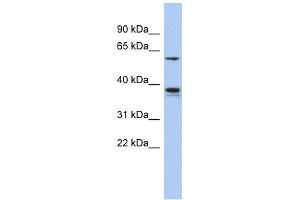 GOPC antibody used at 1 ug/ml to detect target protein.
