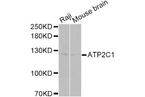Western blot analysis of extracts of various cell lines, using ATP2C1 Antibody (ABIN5975353) at 1/1000 dilution. (ATP2C1 anticorps)