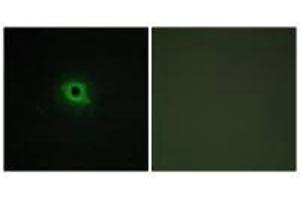 Immunofluorescence analysis of COS-7 cells, using DGKK antibody. (DGKK anticorps  (C-Term))