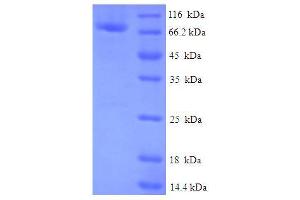 SDS-PAGE (SDS) image for Family with Sequence Similarity 114, Member A2 (FAM114A2) (AA 1-505), (full length) protein (His-SUMO Tag) (ABIN5711865)
