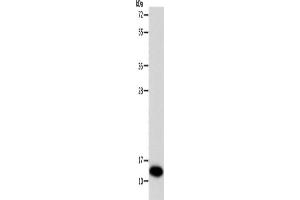 Western Blotting (WB) image for anti-Superoxide Dismutase 1, Soluble (SOD1) antibody (ABIN2422172) (SOD1 anticorps)