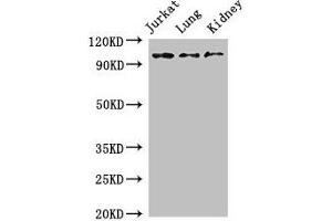 Western Blot Positive WB detected in: Jurkat whole cell lysate, Mouse lung tissue, Mouse kidney tissue All lanes: SMARCAL1 antibody at 3 μg/mL Secondary Goat polyclonal to rabbit IgG at 1/50000 dilution Predicted band size: 106 kDa Observed band size: 106 kDa (SMARCAL1 anticorps  (AA 6-277))