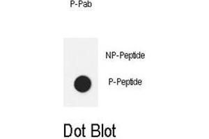 Dot blot analysis of anti-Phospho-IL6ST-Y905 Phospho-specific Pab on nitrocellulose membrane. (CD130/gp130 anticorps  (pTyr905))