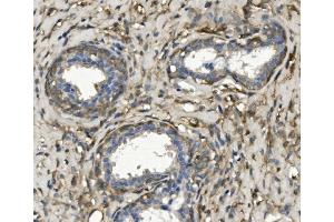 IHC analysis of non-muscle Myosin IIB/MYH10 using anti-non-muscle Myosin IIB/MYH10 antibody (ABIN7603186). (MYH10 anticorps  (N-Term))