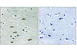 Immunohistochemistry analysis of paraffin-embedded human brain tissue, using Insulin Like Growth Factor 1 Receptor (IGF1R) antibody.