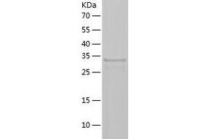 Western Blotting (WB) image for Hydroxysteroid (17-Beta) Dehydrogenase 14 (HSD17B14) (AA 1-306) protein (His-IF2DI Tag) (ABIN7123389)