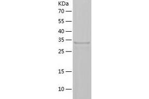 Western Blotting (WB) image for Hydroxysteroid (17-Beta) Dehydrogenase 14 (HSD17B14) (AA 1-306) protein (His tag) (ABIN7123389) (HSD17B14 Protein (AA 1-306) (His tag))