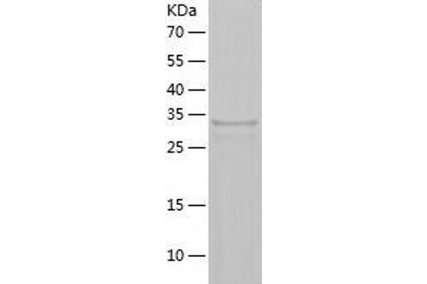 HSD17B14 Protein (AA 1-306) (His tag)