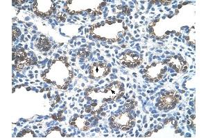 Ankyrin 1 antibody was used for immunohistochemistry at a concentration of 4-8 ug/ml to stain Alveolar cells (arrows) in Human Lung.