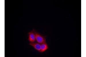 Image no. 1 for anti-VEGF Receptor 2 (VEGFR2) (AA 949-953) antibody (ABIN197241) (VEGFR2/CD309 anticorps  (AA 949-953))