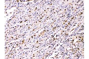 IHC analysis of ATP citrate lyase using anti- ATP citrate lyase antibody .