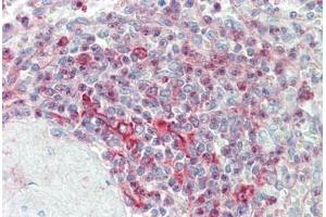 Human Spleen: Formalin-Fixed, Paraffin-Embedded (FFPE)