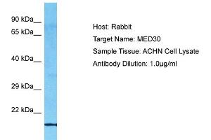 Host: Rabbit Target Name: MED30 Sample Type: ACHN Whole Cell lysates Antibody Dilution: 1. (MED30 anticorps  (C-Term))