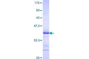 Image no. 1 for ADAM Metallopeptidase Domain 2 (ADAM2) (AA 376-475) protein (GST tag) (ABIN1305857)