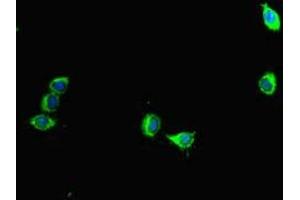 Immunofluorescent analysis of Hela cells using ABIN7145075 at dilution of 1:100 and Alexa Fluor 488-congugated AffiniPure Goat Anti-Rabbit IgG(H+L) (Aurora A anticorps  (AA 1-131))
