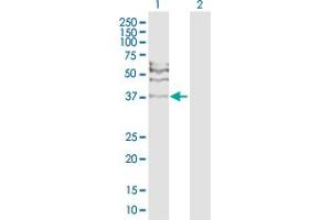 Western Blot analysis of RAD51C expression in transfected 293T cell line by RAD51C MaxPab polyclonal antibody.