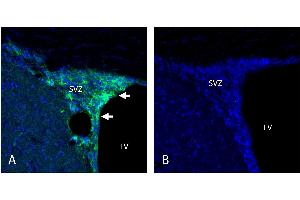 anti-Stromal Interaction Molecule 2 (Stim2) (AA 583-597), (Intracellular) antibody