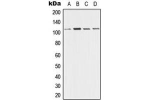 Western blot analysis of Desmoglein 3 expression in A431 (A), HeLa (B), Raw264. (Desmoglein 3 anticorps  (Center))