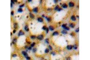 Used in DAB staining on fromalin fixed paraffin-embedded Kidney tissue (Thyroperoxidase anticorps  (AA 636-832))