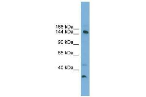 MED14 antibody used at 0. (MED14 anticorps  (Middle Region))