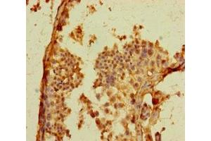 Immunohistochemistry of paraffin-embedded human testis tissue using ABIN7164461 at dilution of 1:100
