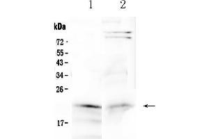 Western blot analysis of Cytoglobin using anti-Cytoglobin antibody .