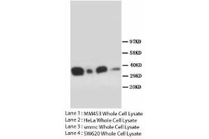 Image no. 1 for anti-Forkhead Box L2 (FOXL2) (N-Term) antibody (ABIN1495192)