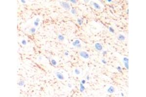 IHC-P analysis of Human Tissue, with DAB staining. (SLC6A3 anticorps  (AA 562-620))