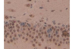 Detection of CD2AP in Rat Brain Tissue using Polyclonal Antibody to CD2 Associated Protein (CD2AP) (CD2AP anticorps  (AA 368-623))